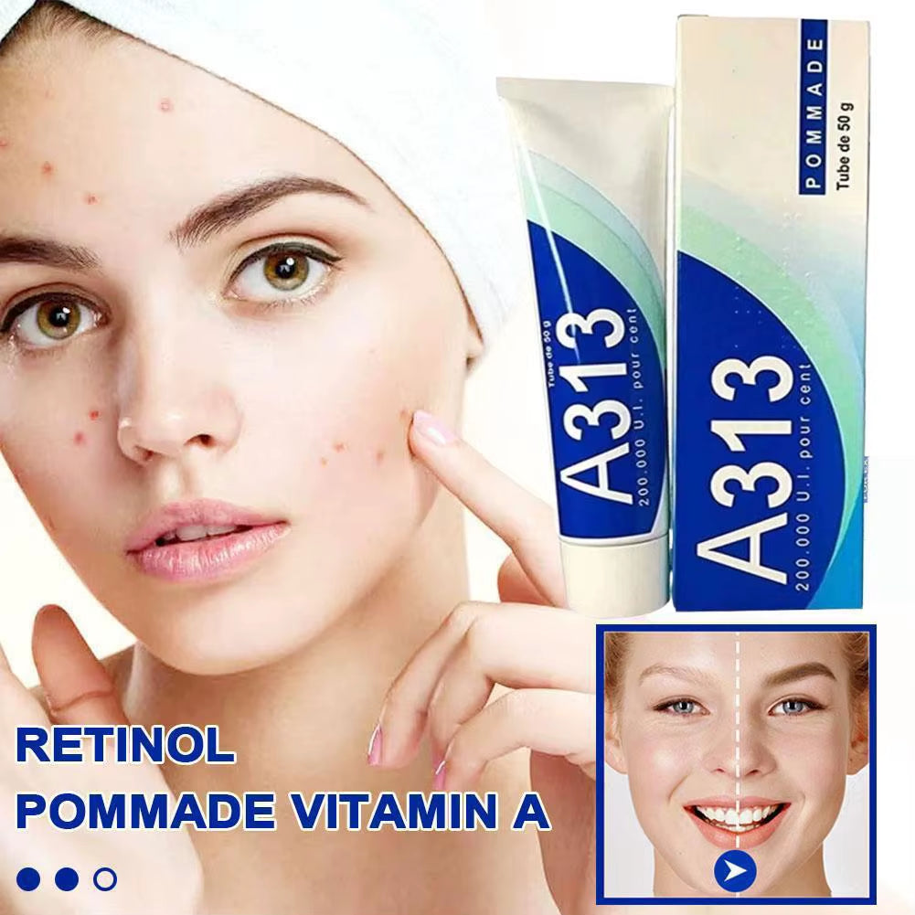 A313 Pure Vitamin a Retinol Cream 50G - Anti-Aging, Moisturizing, Acne Prevention with 200,000 IU Retinyl Palmitate for Face & D