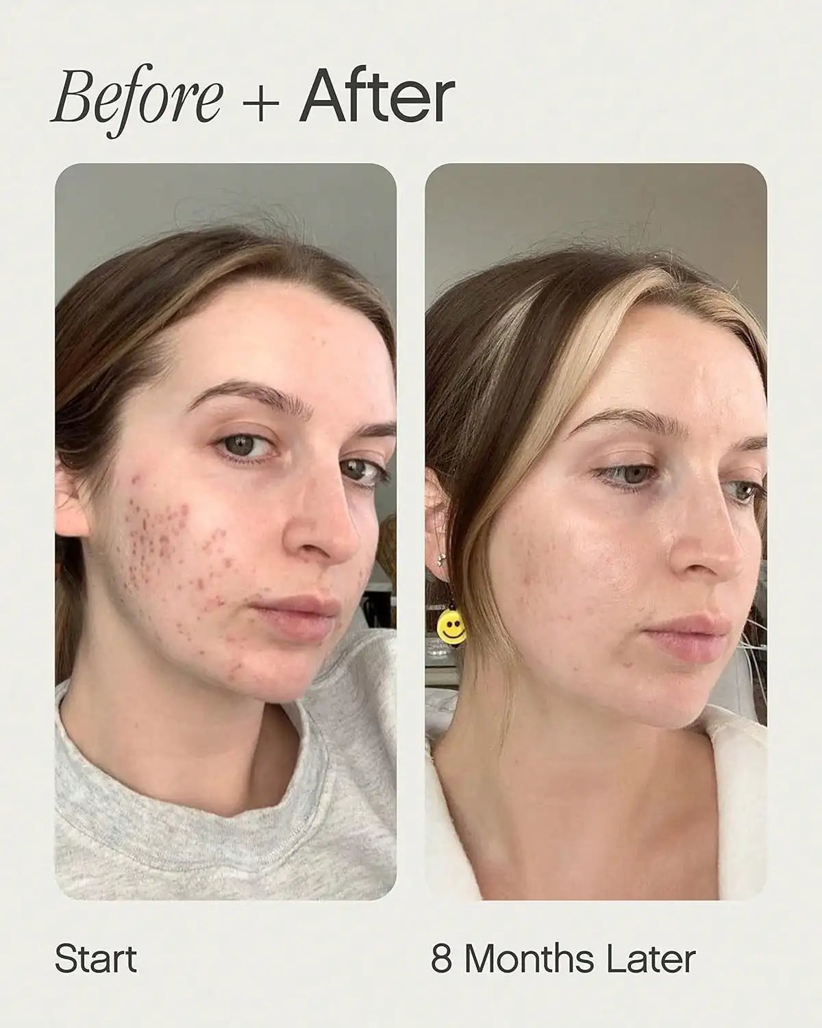 Transform Your Skin with Our Fade, Whiten, and Clear Essence - Say Goodbye to Spots!