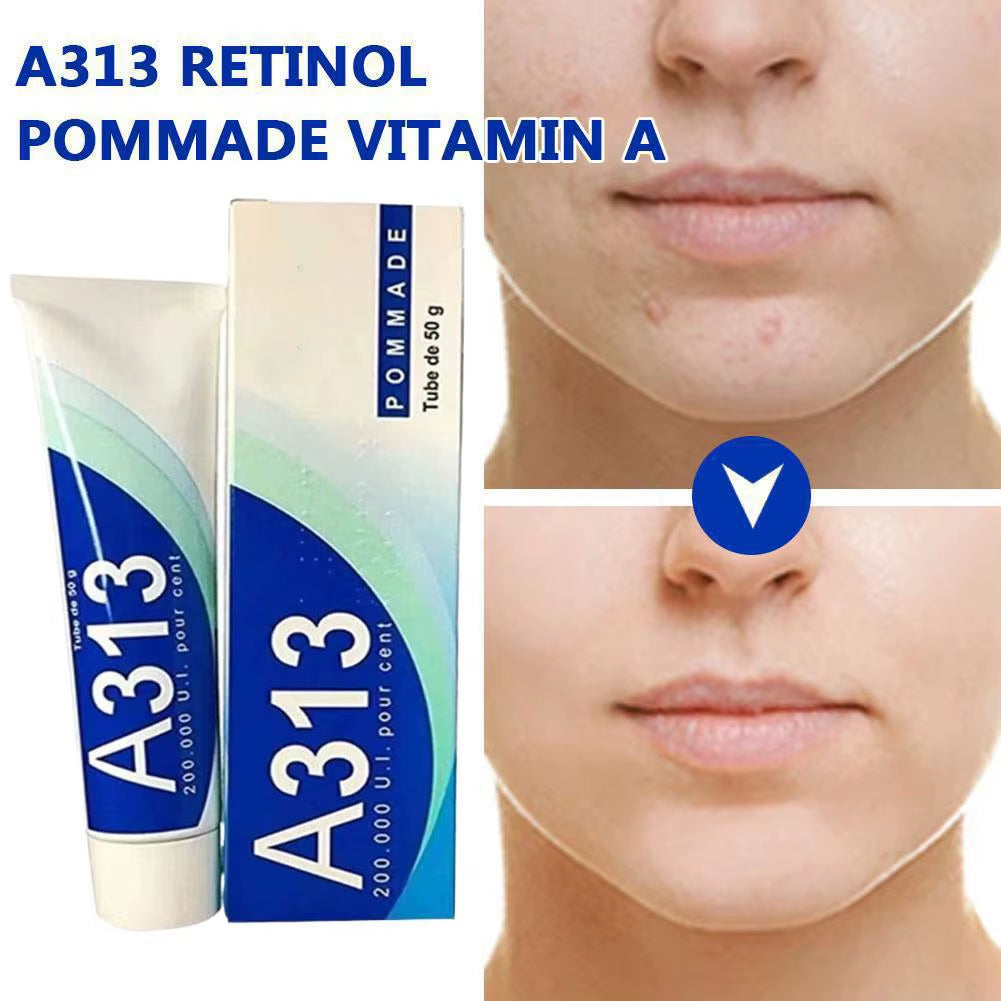 A313 Pure Vitamin a Retinol Cream 50G - Anti-Aging, Moisturizing, Acne Prevention with 200,000 IU Retinyl Palmitate for Face & D